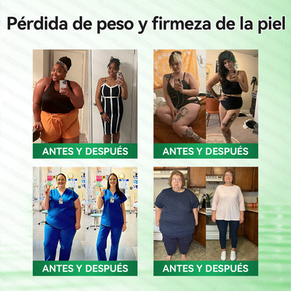 🇺🇸 𝑻𝒊𝒆𝒏𝒅𝒂 𝑶𝒇𝒊𝒄𝒊𝒂𝒍 | 🍎𝑮𝑳𝑶𝑹𝑬𝐍𝐃𝗔® 𝐏𝐚𝐫𝐜𝙝𝙚 𝘼𝙫𝙖𝙣𝙯𝙖𝙙𝗼 𝗱𝗲 𝗠𝗶𝗰𝗿𝗼𝒏𝒂𝒍𝒈𝒂 𝑵𝒂𝐧𝐨 𝟏0-𝙚𝙣-1(𝐒𝐨𝐥𝐨 𝐮𝐧𝐚 𝐯𝐞𝐳 𝐚𝐥 𝐝í𝐚） ✅ 𝐏𝐚𝐫𝐚 𝐥𝐚 𝐨𝐛𝐞𝐬𝐢𝐝𝐚𝐝, 🅟🅘🅔🅛 🅕🅛🅐🅒🅘🅓🅐, 𝐝𝐢𝐚𝐛𝐞𝐭𝐞𝐬, 𝐚𝐩𝐧𝐞𝐚 𝐝𝐞𝐥 𝐬𝐮𝐞ñ𝐨, 𝐩𝐫𝐨𝐛𝐥𝐞𝐦𝐚𝐬 𝐚𝐫𝐭𝐢𝐜𝐮𝐥𝐚𝐫𝐞𝐬, 𝐲 𝐦𝐮𝐜𝐡𝐨 𝐦á𝐬